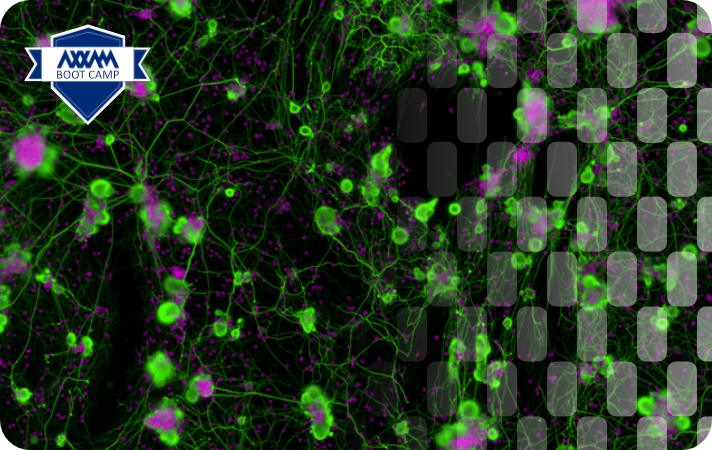 High Content Screening in early drug discovery