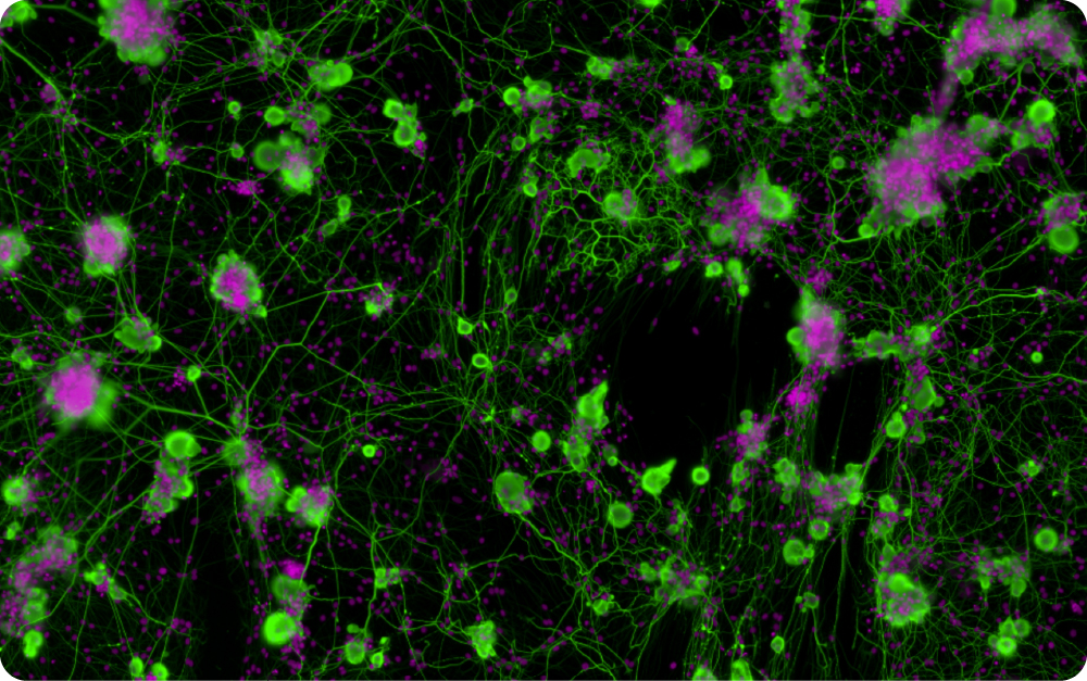 Neurons (rat DRG cells) and neurites stained with β-III Tubulin (Green LUT) in co-culture with glial cells (Pink LUT). 20X Magnification