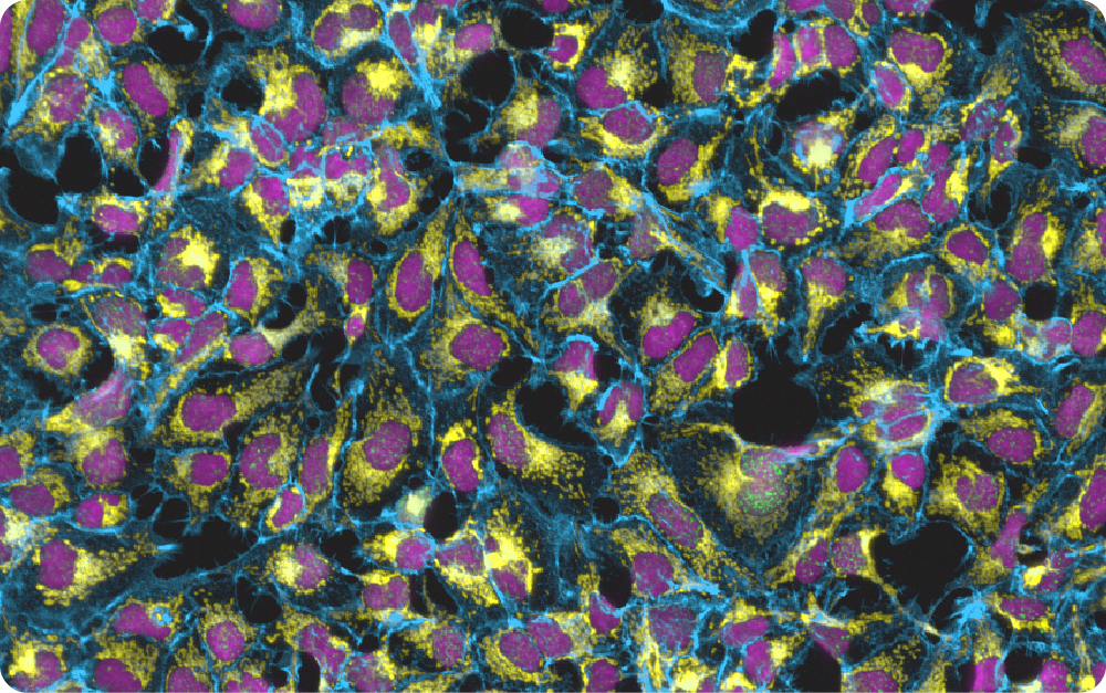CellPainting of HeK293 cells treated with a DNA damaging agent (Etoposide). Mitochondria are stained using an anti TOM20 antibody (yellow LUT). The membrane is stained with phalloidin (blue LUT). Nuclei are labelled with DAPI (pink LUT) and γH2AX DNA damage foci are represented in green LUT. 20X Magnification