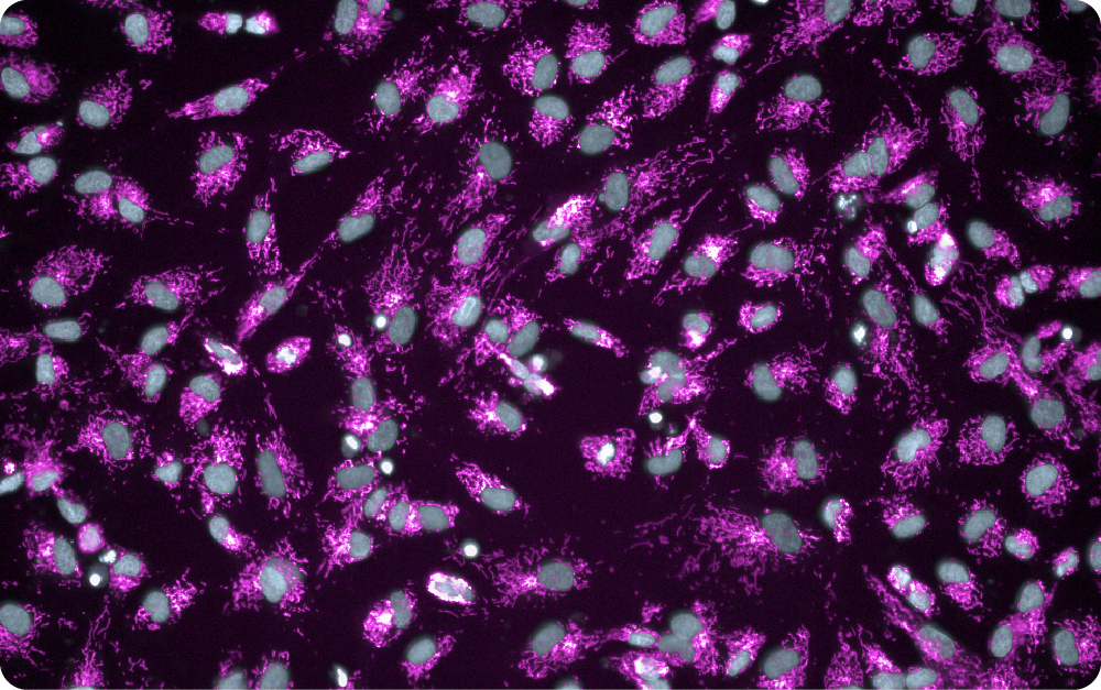 HeK293 stained with a dye labelling mitochondrion (pink LUT) and nuclei (gray LUT).