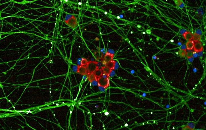 Cell Painting on FCDI iPSC-derived neurons