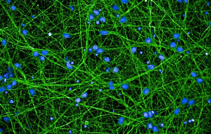 picture of iPSC-dopaneurons (FCDI) stained with b-II tubulin (neurons and neurites-green) and Hoechst for nuclei (blue) - representative of a single fov of a 384-well