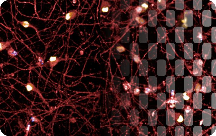 Scalable CRISPR functional genomics in human iPSC-derived motor neurons using multi-omics phenotypic profiling