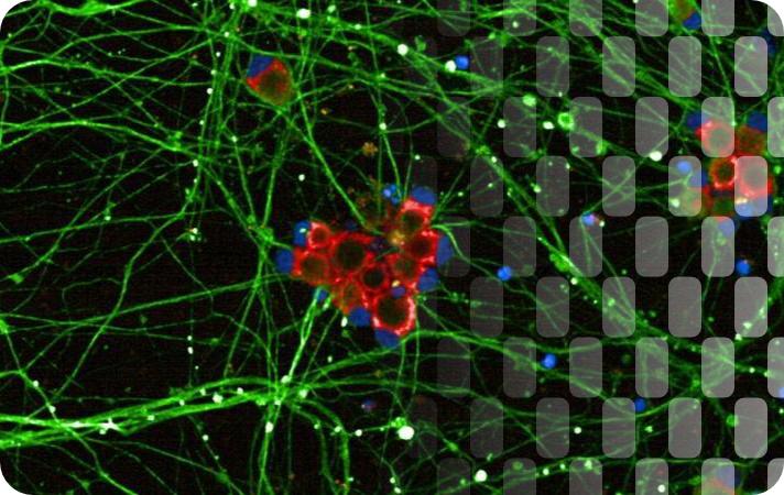 Axxam’s integrated approach: a complexity-escalating strategy for bringing NAMs to human-relevant drug discovery